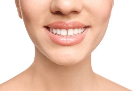 Woman with a slight gap between front teeth